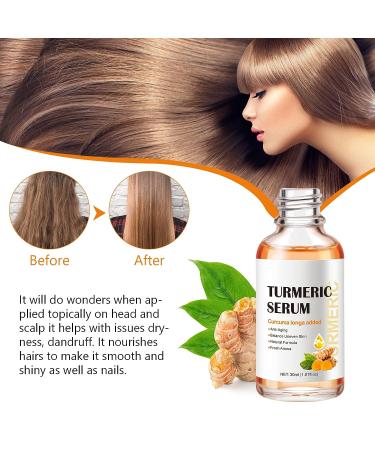 Turmeric Dark Spot Corrector Serum for Women - Anti-Aging Face Serum with Curcuma Longa - Even Skin Tone, Remove Dark Spots & Age Spots - Daily Skin Care Solution - Buy Online on GoSupps.com