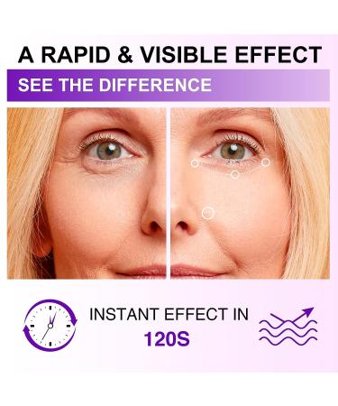 ZealSea Retinol Eye Cream for Dark Circles and Puffiness - Anti Aging Serum with Caffeine & Peptides - Reduce Fine Lines and Wrinkles - 0.7 OZ - Buy Online on GoSupps.com