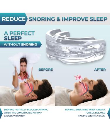 Anti Snoring Devices Anti Snoring Mouth Guard Stop Snoring Devices Adjustable Snore Stopper for Sleep Effective Snoring Solution Anti-Snoring Mouthpiece for Men and Women to Stop Snoring - Buy Online on GoSupps.com