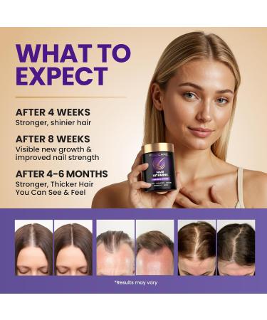Biotin Hair Growth Supplement with Collagen, Keratin, and Probiotics Hair Growth Support, Skin & Nails Supplement for Men and Women Supports Thicker, Stronger Hair Made in USA (1 Pack) 60 Count (Pack of 1) - Buy Online on GoSupps.com