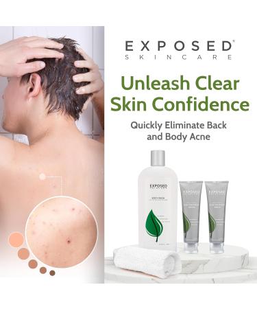 Exposed Skin Care Body Acne Kit - Dual Serums Wash & Cloth - Fast Relief for Back & Body Pimples - Buy Online on GoSupps.com