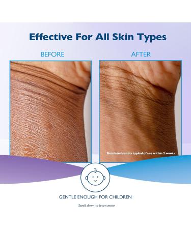 Glaxal Base Daily Moisturizing Lotion with Vitamin E for Dry Skin and Sensitive Skin Hypoallergenic & Paraben-Free 227g Vitamin E Lotion - Buy Online on GoSupps.com