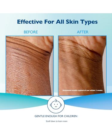 Glaxal Base Daily Moisturizing Lotion for Dry Skin and Sensitive Skin Hypoallergenic & Paraben-Free 227g 227 g (Pack of 1) - Buy Online on GoSupps.com