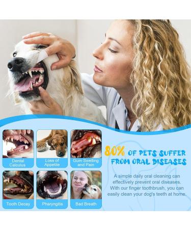 Adiwo Dog Toothbrush Finger 12 Pcs Reusable Dog Finger Toothbrush Anti-Plaque 360 Full-Surrounded Bristles Dog Tooth Brush Efficient Dog Teeth Cleaning Products for Dogs and Cats - Buy Online on GoSupps.com