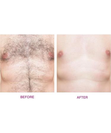 Rio Beauty Total Body Waxing Hair Removal Kit - Professional at-home hair removal solution - Buy Online on GoSupps.com