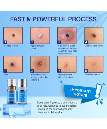 Pureskin Skin Tag Remover & Mole Corrector And Repair Lotion Set Remove Tags and Moles Effortlessly - Buy Online on GoSupps.com