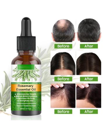 100% Pure Natural Rosemary Oil - Multipurpose Hair Oil for Growth Nourishing Scalp & Strengthening Hair - Buy Online on GoSupps.com