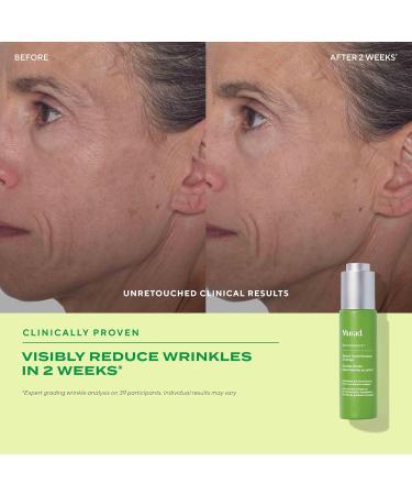 Murad Retinol Youth Renewal Oil Drops Anti-Aging Retinol Facial Oil with Omega-Rich Oils Hydrates Smooths Fine Lines & Wrinkles Lightweight Fast-Absorbing Skincare Treatment 1.0 oz - Buy Online on GoSupps.com