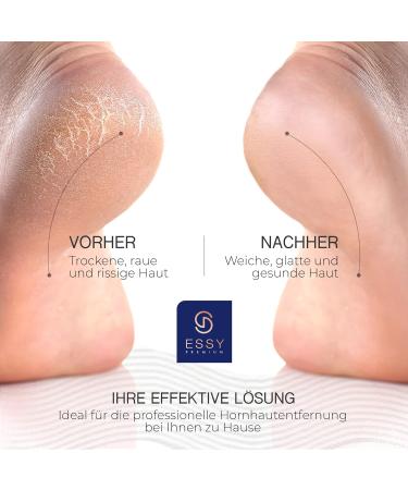 Essy Horn Skin Remover - Best Electrical Foot Care Device with 5 Replacement Rolls | Pedicure Set for Smooth Feet - Buy Online on GoSupps.com