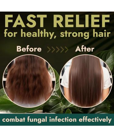 Terramed Just Think Comfort Tea Tree Shampoo & Conditioner Set - Itchy Scalp Hair Loss & Dandruff Relief | Nourishing Sulfate & Paraben Free Haircare for All Hair Types - Buy Online on GoSupps.com