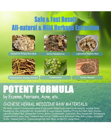 NJUDE Psoriasis & Eczema Cream | All-Natural Herbal Anti-Itch Lotion 1.1oz | Soothes & Hydrates Irritated Skin | Eczema Relief - Buy Online on GoSupps.com