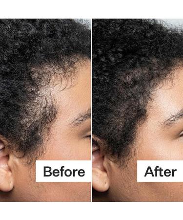 Root Cover Up Natural Looking Root Touch Up Powder Quick and Easy Hairline Shadow Powder with Brush and Mirrored Compact Root Cover Up Instantly Hairline (Black) - Buy Online on GoSupps.com