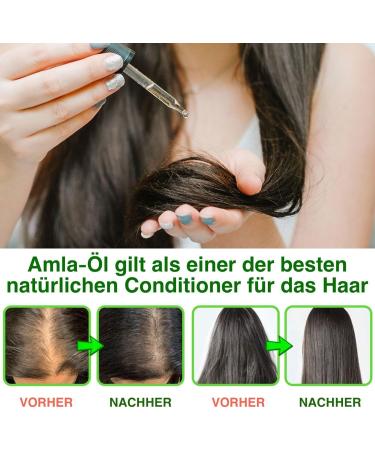  p-beauty Amla Hair Oil for Intense Hair Growth - Fights Dandruff and Hair Loss - Cold-Pressed - Organic and Vegan - Vitamin C - Amino Acid - 3 x 60 ml - Buy Online on GoSupps.com