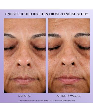 Lanc me R nergie H.C.F. Triple Serum & H.P.N. 300-Peptide Face Cream Duo - Helps Visibly Reduce Lower Face Sagging Wrinkles & Dark Spots - Buy Online on GoSupps.com