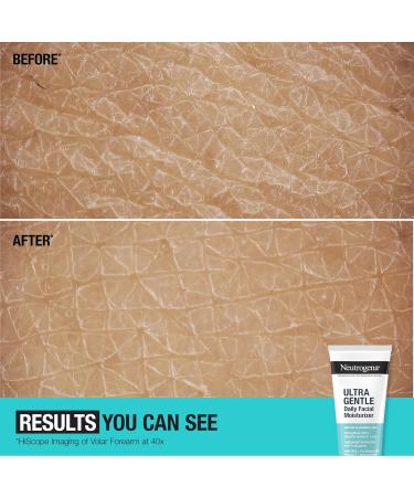 Neutrogena Fragrance Free Daily Facial Moisturizer for Sensitive & Dry Skin - Vitamin B3 B5 & E 3.4 fl. oz - International Shipping Available - Buy Online on GoSupps.com