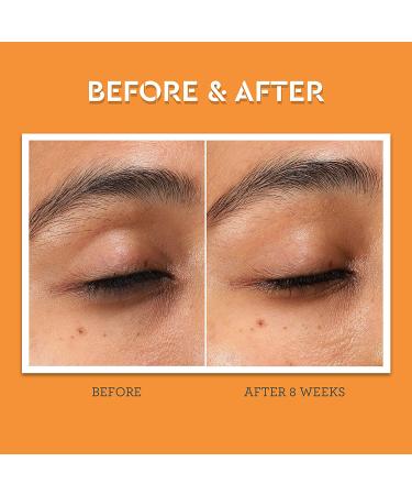 Bliss Rest Assured Eye Cream | Dark Circle Reducing & Depuffing with Vitamin C & Caffeine | Clean, Cruelty-Free, Vegan | 0.5 oz - Buy Online on GoSupps.com