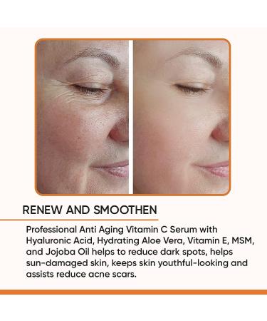 Vitamin C Hyaluronic Acid Serum for Face | Anti Aging, Dark Spot, Wrinkle, Acne Scar Treatment - Buy Online on GoSupps.com
