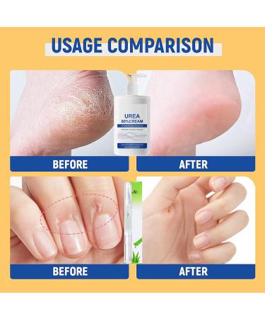 MrCuvaryas 60 Urea Cream 200 ml foot care for foot cream very dry feet moisturizing and anticrack foot cream hand cream with nail care oil foot cream for cracked feet heels elbows - Buy Online on GoSupps.com