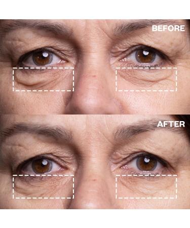 Wrinkles Schminkles Under Eye Wrinkle Starter Pack - Reusable Patches & Cleanser for Smoother Eyes | Shop Internationally - Buy Online on GoSupps.com