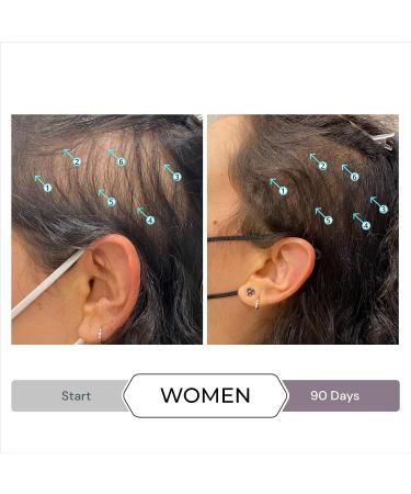 Spectral.CSF Leave In Serum for Thinning Hair in Women | DS Laboratories | Promotes Hair Growth, Thicker & Fuller Hair | 60ml (2 fl oz) - Buy Online on GoSupps.com