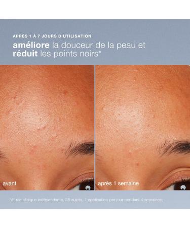 Dermalogica Daily Microfoliant - Exfoliant doux iconique quotidien la poudre de riz. Lisse le grain de peau unifie et illumine le teint 40 g (Lot de 1) - Buy Online on GoSupps.com