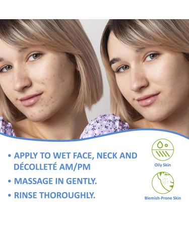 Dermisklean Acne Wash - Exfoliating Facial Cleanser with Glycolic & Salicylic Acid for Oily Blemish-Prone Skin (120 ML) - Non-Comedogenic Daily Use - Buy Online on GoSupps.com