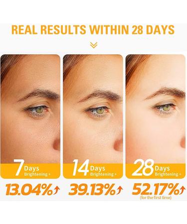 Trendyfave 20% Vitamin C Serum For Face Vitamin C Serum With Hyaluronic Acid Vit C Serum Face Hydrating Face Serum Hydrating & Plump Skin 2FL.OZ - Buy Online on GoSupps.com