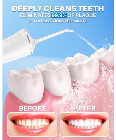 Water Dental Flosser - Cordless Rechargeable 300ML Oral Irrigator | IPX7 Waterproof 3 Modes Portable with 4 Jet Tips for Home & Travel - Buy Online on GoSupps.com