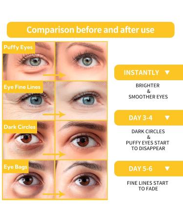 BREYLEE 24K Gold Under Eye Patches - 60 Pcs for Wrinkles Dark Circles & Puffy Eyes | Natural Extract Eye Masks - Buy Online on GoSupps.com