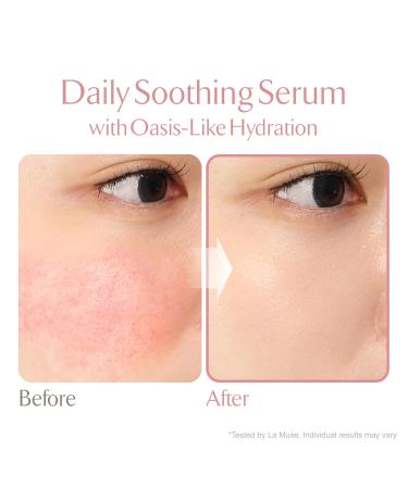 LA MUSE Oasis Soothing Serum(Pouch / 2.71 fl oz) | Gel Moisturizer for Face Instant Soothing with Cica | Hydrolyzed Collagen Hydro Boost for Deep Hydration & Radiance | Non-Sticky & Fast-Absorbing - Buy Online on GoSupps.com
