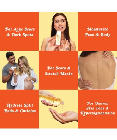 Bio-Oil Skincare Oil for Scars & Stretchmarks w/ Jojoba, Vitamin E & Rosehip - 4.2 oz - Buy Online on GoSupps.com