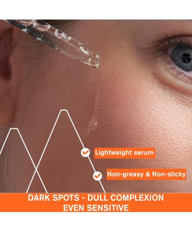 Uriage D piderm Anti-Dark Spot Serum Brightening Booster 30ml - Concentrated 20% Vitamin C Complex & Niacinamide - Reduces Dark Spots in 28 Days! 94% Natural Ingredients - Suitable for Sensitive Skin - Buy Online on GoSupps.com