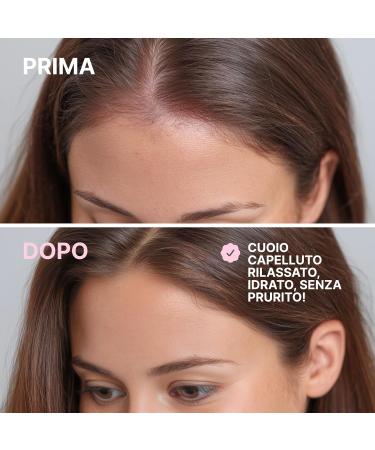 Balance SOS Calming Shampoo - Shampooing apaisant et calmant - Shampooing pour cuir chevelu stress et irritant - Shampooing capillaire aux prot ines de bl pour un apaisement durable- 250 ml - Buy Online on GoSupps.com