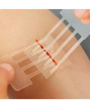 Clozex Wound Closure Device - FDA Cleared Laceration Repair Without Stitches - 3 Sizes for International Shipping - Buy Online on GoSupps.com