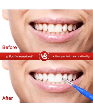Tophonex 100 Packs Interdental Brush Toothpicks - Effective Oral Dental Cleaners with Storage Box (Red & Blue) - International Shipping Available - Buy Online on GoSupps.com