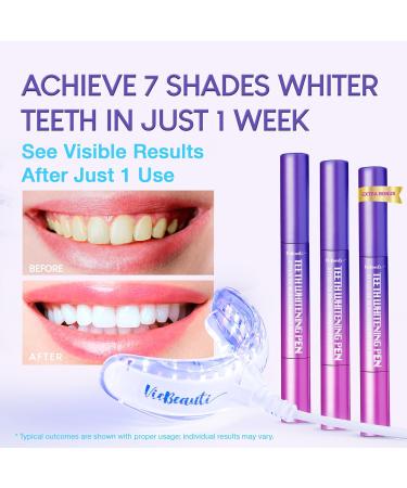 VieBeauti Deluxe Teeth Whitening Kit - Enamel-Safe LED Light & Gel Pen for Sensitive Teeth - Professional Stain Removal - Buy Online on GoSupps.com