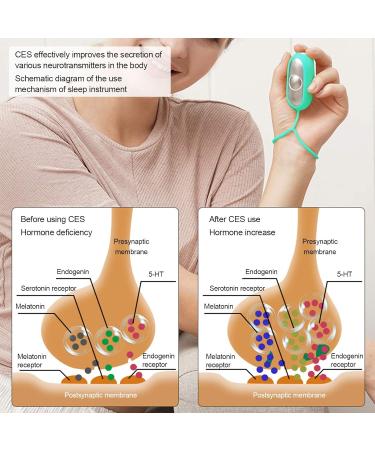 Microcurrent Sleep Aid Device for Insomnia and Stress Relief - USB Charging, Anxiety and Pressure Relief Instrument - Buy Online on GoSupps.com