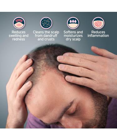 Seborrheic Dermatitis Shampoo Peat For Treatment Of Dry Itchy And Flaky Scalp. Also Helps Treat Dandruff Psoriasis And Eczema. 250 ml - Buy Online on GoSupps.com