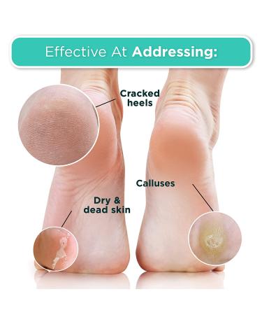 Dermora Foot Peel Mask - 2 Pack for Dry, Cracked Feet - Exfoliating & Softening Treatment with Coconut Scent - Buy Online on GoSupps.com