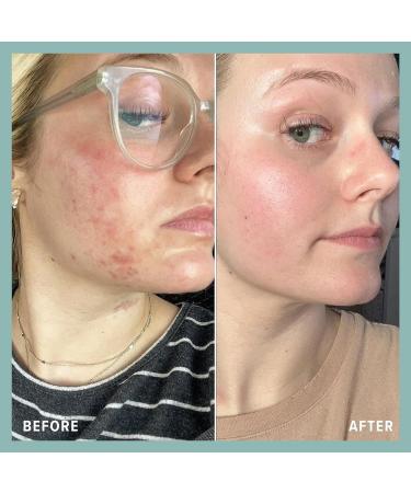 Bohemia Vegan Cleansing Balm - Hydrating Makeup Remover for All Skin Types - Nourishing Oil-Based Facial Cleanser (2oz - Buy Online on GoSupps.com