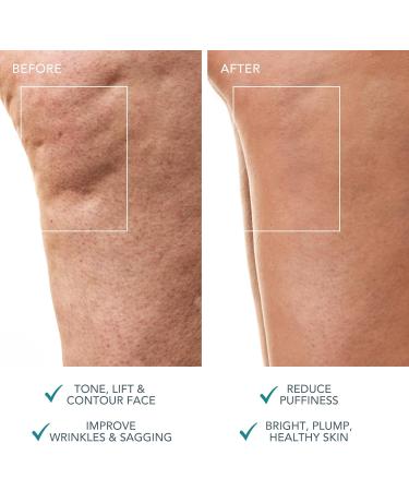 Buy FOREO BEAR 2 Anti-Cellulite Massager - Microcurrent Body Contour & Lymphatic Drainage - Enhance Skincare Absorption - International Shipping Available - Buy Online on GoSupps.com
