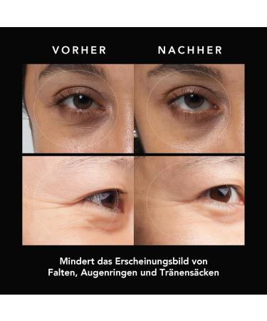 FAQ Microneedling Eye Pads with Hyaluronic Acid for Wrinkles & Dark Circles - Instant Non-Invasive Results - Perfect On-the-Go Solution - 3x2 Pcs - Buy Online on GoSupps.com