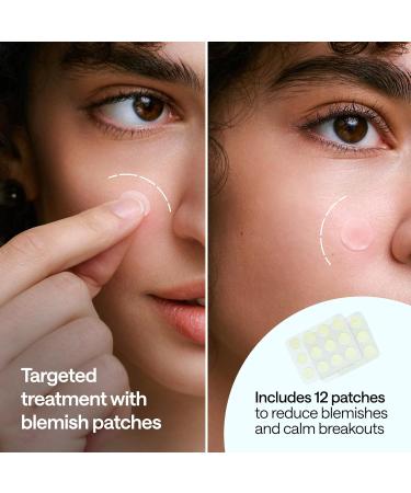 Hypochlorous Acid Spray for Face and Skin - Body & Facial Toner for Acne - Eyelid Cleanser - Moisturizing Face Spray Mist Hydrating - 6.8 Fl Oz - 12 Blemish Patches - Buy Online on GoSupps.com