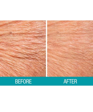 Dermactin Crepe Skin Firming Cream 2.5 oz. (PACK OF 2) - Buy Online on GoSupps.com