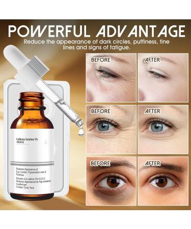 Serum Yeux+Patch Micro Aiguilles Contour des Yeux Anti Rides Cafeine Contours des Yeuxs Caf ine 5% + Egcg Serum Contour des Yeuxs Serums Yeuxs Anti Cernes et Poche 30 ml (Lot de 1) - Buy Online on GoSupps.com