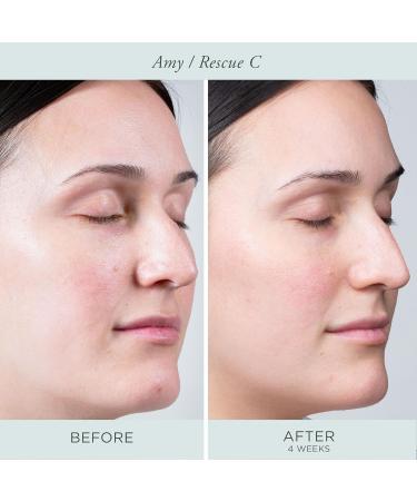 P R Beauty Rescue C Brightening Vitamin C & Peptide Eye Cream - Hydrate & Revitalize Your Eyes | 0.5 oz - Shop Internationally - Buy Online on GoSupps.com