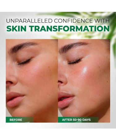 Organic Rice Cream for Face - Ceramide Moisturizing Cream with Hyaluronic Acid & Black Rice Extract - Vegan Facial Essence for Radiant Skin - Buy Online on GoSupps.com