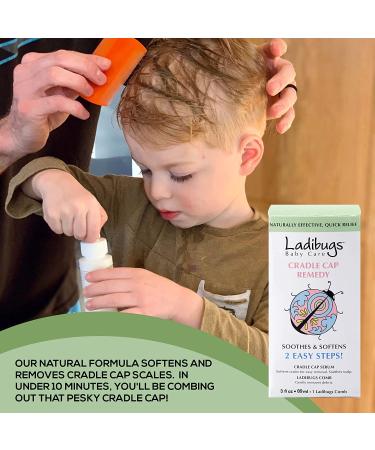 Ladibugs Cradle Cap Remedy Kit 3oz | Serum & Comb | Removes Scales, Soothes Scalp - Buy Online on GoSupps.com