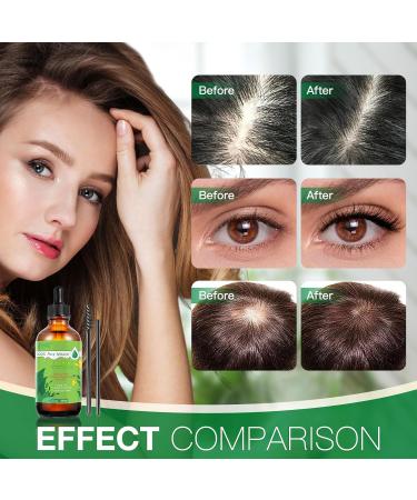 Chimoo 100% Natural Rosemary Oil for Hair - 60ml Hair Growth & Aromatherapy Essential Oil for Men & Women - Buy Online on GoSupps.com
