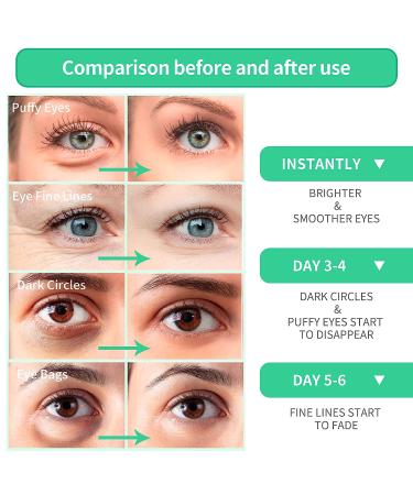 BREYLEE Aloe Vera Eye Mask 60 Pcs - Reduce Puffy Eyes & Dark Circles, Anti-Aging Treatment for Wrinkles, Fine Lines, Firm Under Eye Skin - Natural Extracts | Green - Buy Online on GoSupps.com